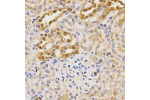 Immunohistochemistry of paraffin-embedded rat kidney using ATG5 antibody at dilution of 1:200 (x400 lens). (ATG5 anticorps  (AA 1-275))