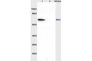 Lane 1: rat brain lysates Lane 2: rat liver lysates probed with Anti CDKAL1 Polyclonal Antibody, Unconjugated (ABIN873056) at 1:200 in 4 °C. (CDKAL1 anticorps  (AA 375-460))