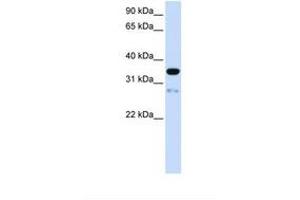 Image no. 1 for anti-Transmembrane Protein 38A (TMEM38A) (AA 74-123) antibody (ABIN6738623) (TMEM38A anticorps  (AA 74-123))