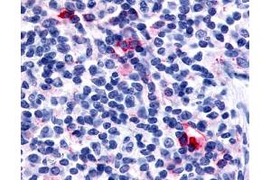 Anti-CXCR6 antibody IHC of human tonsil, interfollicular zone.