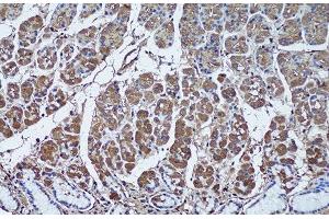 Immunohistochemistry of paraffin-embedded Human stomach using SFRP1 Polyclonal Antibody at dilution of 1:50 (20x lens). (SFRP1 anticorps)