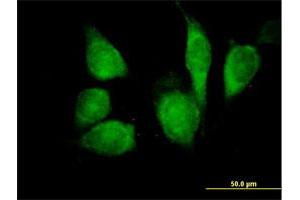 Immunofluorescence of purified MaxPab antibody to CDKN1B on HeLa cell. (CDKN1B anticorps  (AA 1-198))