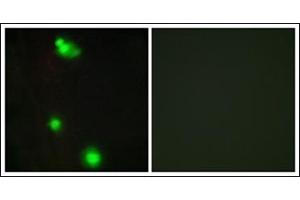 Immunofluorescence analysis of MCF7 cells, using SFRS3 Antibody. (SRSF3 anticorps  (C-Term))
