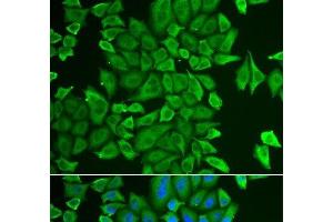 Immunofluorescence analysis of HeLa cells using APEH Polyclonal Antibody (APEH anticorps)