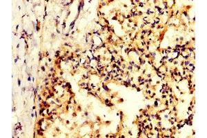 IHC image of ABIN7156276 diluted at 1:200 and staining in paraffin-embedded human lung tissue performed on a Leica BondTM system. (Pyrophosphatase (Inorganic) 1 (PPA1) (AA 59-173) anticorps)