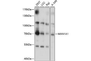 Western blot analysis of extracts of various cell lines, using M antibody (0830) at 1:1000 dilution. (MAN1A1 anticorps  (AA 70-190))