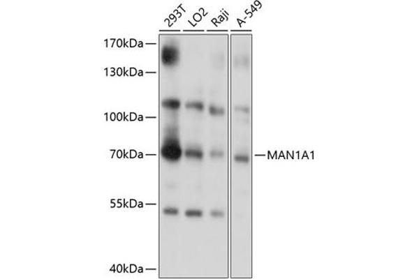 MAN1A1 anticorps  (AA 70-190)