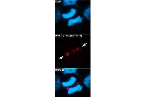 Immunofluorescent staining of methanol-fixed U87 cells using MYL2 (phospho Y118) polyclonal antibody  at 1:100-1:200 dilution. (MYL2 anticorps  (pTyr118))