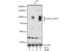 Western blot analysis of extracts of A-549 cells, using ICAM-1/CD54 antibody (ABIN6129231, ABIN6142118, ABIN6142120 and ABIN6221235) at 1:1000 dilution. (ICAM1 anticorps  (AA 250-480))