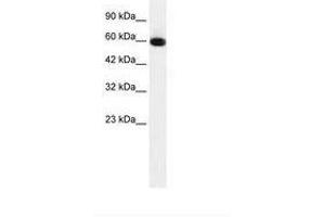 Image no. 1 for anti-GLIS Family Zinc Finger 2 (GLIS2) (AA 183-232) antibody (ABIN6735915) (GLIS2 anticorps  (AA 183-232))