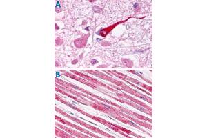 Immunohistochemistry (Formalin/PFA-fixed paraffin-embedded sections) of human brain (A) and human heart tissue (B) with GALR1 polyclonal antibody . (Galanin Receptor 1 anticorps  (Extracellular Domain))
