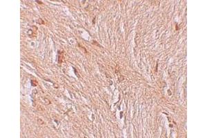 Immunohistochemistry (IHC) image for anti-Zinc Finger and BTB Domain Containing 3 (ZBTB3) (C-Term) antibody (ABIN1030811) (ZBTB3 anticorps  (C-Term))