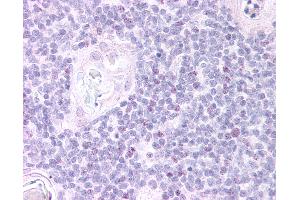 Anti-FOXN1 antibody IHC of human thymus, medulla.