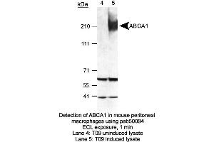 Image no. 2 for anti-ATP-Binding Cassette, Sub-Family A (ABC1), Member 1 (ABCA1) (AA 1100-1300) antibody (ABIN363393) (ABCA1 anticorps  (AA 1100-1300))