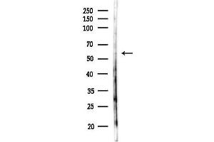 anti-Malonyl CoA Decarboxylase (MLYCD) (Internal Region) antibody