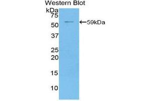 Western Blotting (WB) image for anti-5'-Nucleotidase, Ecto (CD73) (NT5E) (AA 29-550) antibody (ABIN1077722) (CD73 anticorps  (AA 29-550))