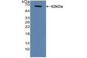 Detection of Recombinant FXR, Human using Polyclonal Antibody to Farnesoid X Receptor (FXR)