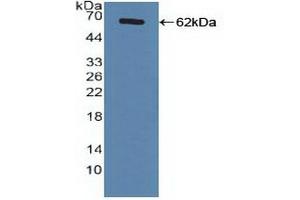 Detection of Recombinant FXR, Human using Polyclonal Antibody to Farnesoid X Receptor (FXR) (NR1H4 anticorps  (AA 211-486))