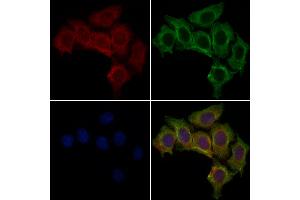 KC1AL Antibody staining HepG2 cells by IF/ICC. (CSNK1A1L anticorps  (C-Term))