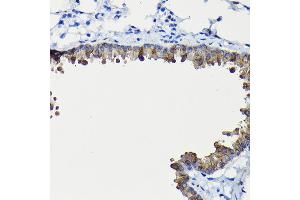 Immunohistochemistry of paraffin-embedded mouse lung using FUC Rabbit pAb (ABIN6127916, ABIN6140809, ABIN6140811 and ABIN6215812) at dilution of 1:200 (40x lens). (FUCA2 anticorps  (AA 118-467))