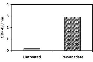 Image no. 1 for Janus Kinase 1 (JAK1) ELISA Kit (ABIN1981723)