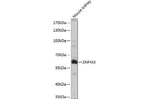 Western blot analysis of extracts of Mouse kidney using ZNF416 Polyclonal Antibody at dilution of 1:1000. (ZNF416 anticorps)