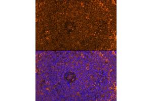 anti-Family with Sequence Similarity 65, Member B (FAM65B) (AA 1-210) antibody