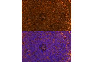 Immunofluorescence analysis of Rat spleen using FB antibody (ABIN6129339, ABIN6140465, ABIN6140466 and ABIN6224941) at dilution of 1:100. (FAM65B anticorps  (AA 1-210))
