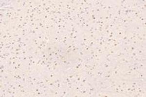Immunohistochemistry analysis of paraffin-embedded mouse substantia nigra using UBLCP1 (ABIN7076132) at dilution of 1: 4200 (UBLCP1 anticorps)