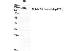 Western Blot (WB) analysis of specific cells using Cleaved-Notch 2 (D1733) Polyclonal Antibody. (NOTCH2 anticorps  (Asp1733, cleaved))