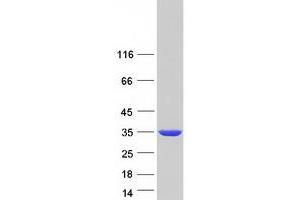 Validation with Western Blot