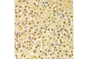 Immunohistochemistry of paraffin-embedded mouse kidney using CDC25A antibody (ABIN5970519) at dilution of 1/100 (40x lens). (CDC25A anticorps)