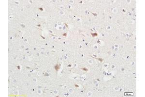 Formalin-fixed and paraffin embedded rat liver tissue labeled with Anti-ABHD5 Polyclonal Antibody, Unconjugated (ABIN708596) at 1:200 followed by conjugation to the secondary antibody and DAB staining (ABHD5 anticorps  (AA 281-349))