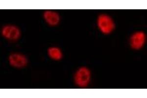 ABIN6275127 staining HepG2 by IF/ICC. (FOXB2 anticorps  (Internal Region))