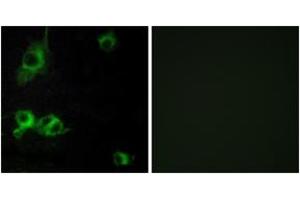 Immunofluorescence (IF) image for anti-Laminin, alpha 1 (LAMA1) (AA 2501-2550) antibody (ABIN2889998) (Laminin alpha 1 anticorps  (AA 2501-2550))