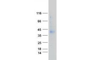 Validation with Western Blot