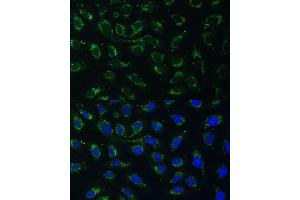 Immunofluorescence analysis of U-2 OS cells using C2 Polyclonal Antibody (ABIN7265549) at dilution of 1:100 (40x lens).