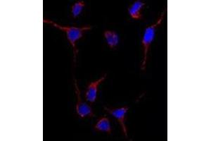 Image no. 1 for anti-Aldehyde Dehydrogenase 1 Family, Member A1 (ALDH1A1) (Center) antibody (ABIN356973) (ALDH1A1 anticorps  (Center))