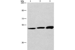 Western Blot analysis of adrenal pheochromocytoma tissue,Jurkat and A549 cell using VWA5A Polyclonal Antibody at dilution of 1:275 (VWA5A anticorps)