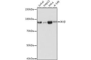 Western blot analysis of extracts of various cell lines, using IKKβ antibody (ABIN7267873) at 1:1000 dilution.