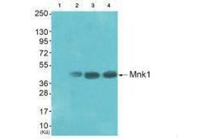 Western blot analysis of extracts from HepG2 cells (Lane 2), K562 cells (Lane 3) and Jurket cells (Lane 4), using Mnk1 (Ab-385) antiobdy. (MKNK1 anticorps  (Thr385))