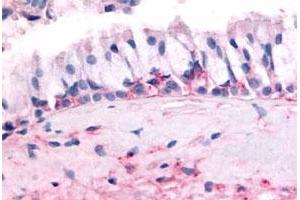 Immunohistochemical (Formalin/PFA-fixed paraffin-embedded sections) staining in human nasal mucosa, respiratory epithelium with OR10J5 polyclonal antibody . (OR10J5 anticorps  (2nd Extracellular Domain))