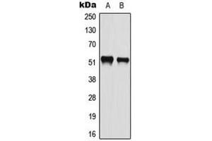 Western blot analysis of ATF2 (pS112) expression in HeLa (A), A549 (B) whole cell lysates. (ATF2 anticorps  (pSer112))