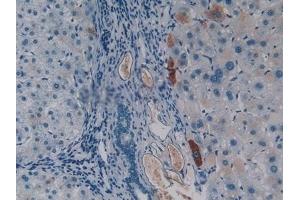 Detection of CASP4 in Human Liver Tissue using Polyclonal Antibody to Caspase 4 (CASP4)