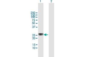 Western Blot analysis of RAD54B expression in transfected 293T cell line by RAD54B MaxPab polyclonal antibody.