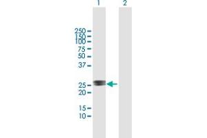 Western Blot analysis of RAD54B expression in transfected 293T cell line by RAD54B MaxPab polyclonal antibody. (RAD54B anticorps  (AA 1-158))