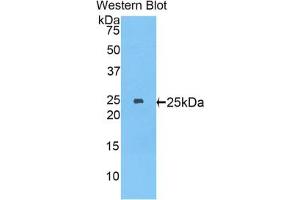 Western blot analysis of the recombinant protein. (MYH8 anticorps  (AA 40-240))