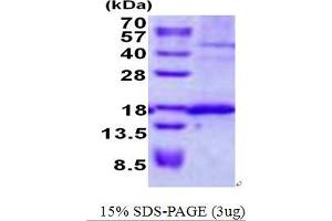 Signal Sequence Receptor, delta (SSR4) protein (His tag)