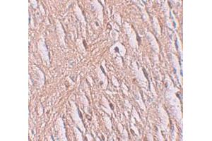 Immunohistochemistry (IHC) image for anti-Solute Carrier Family 39 (Zinc Transporter), Member 9 (SLC39A9) (N-Term) antibody (ABIN1031684) (SLC39A9 anticorps  (N-Term))