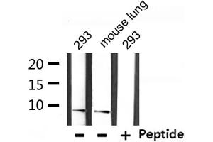 Western blot analysis of extracts from 293 and mouse lung, using Ubiquitin Antibody. (UBA52 anticorps  (Internal Region))